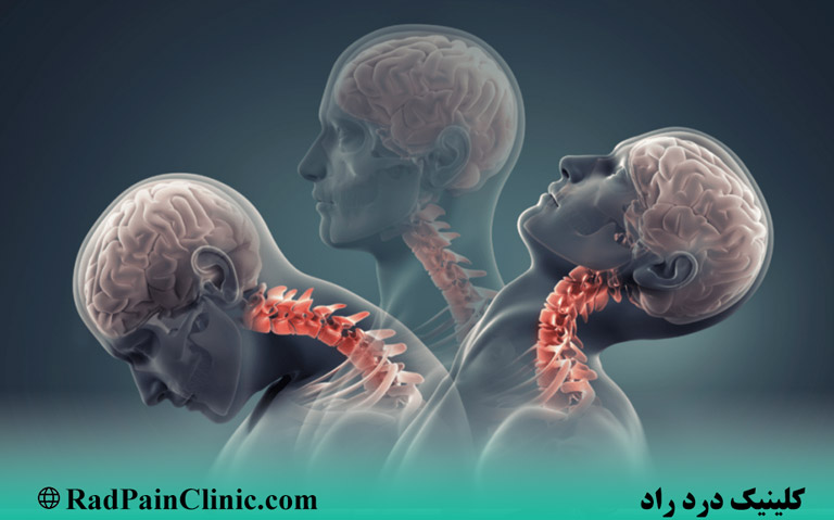 دیسک گردن چیست؟ علائم و درمان آن