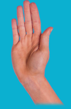 درمان انگشت ماشه ای در کلینیک درد راد