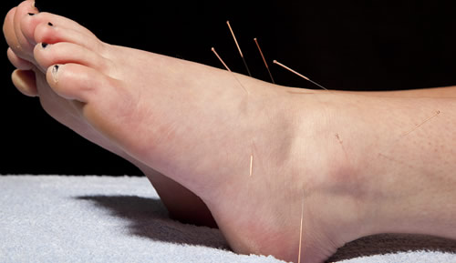 درمان سندروم پای بی‌قرار در کلینیک درد راد